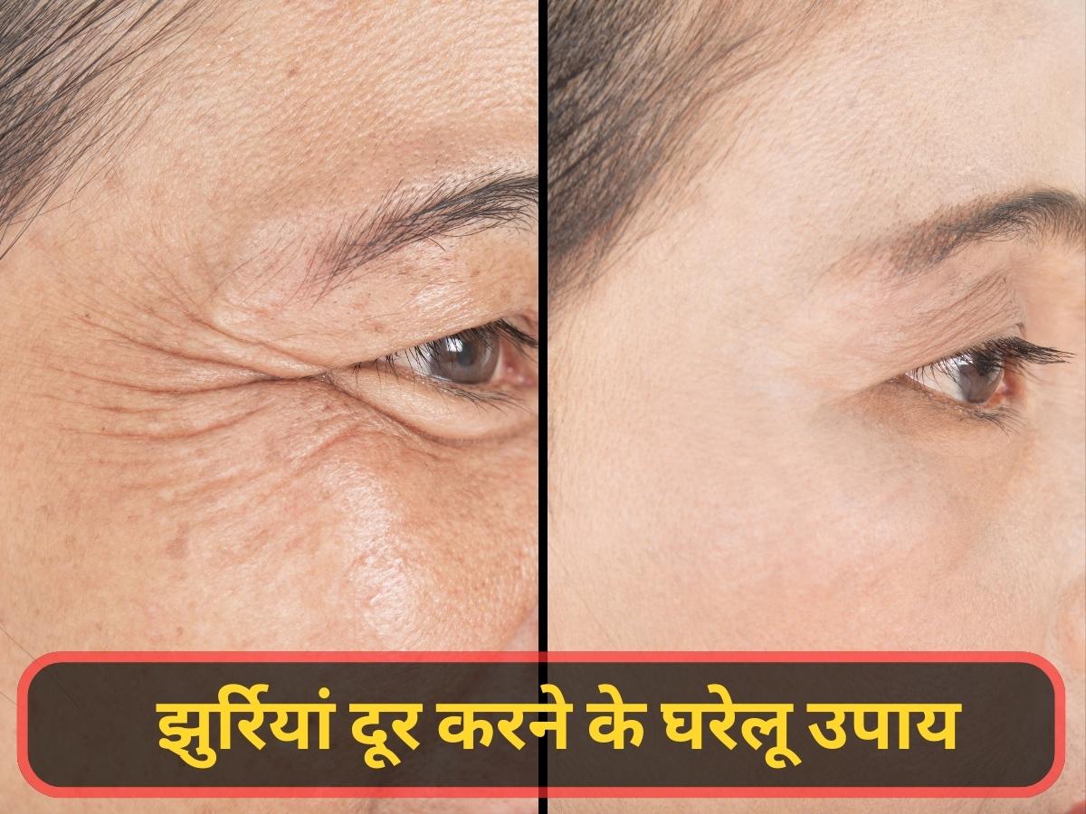 Kitchen remedies remove wrinkles and make skin shiny which these