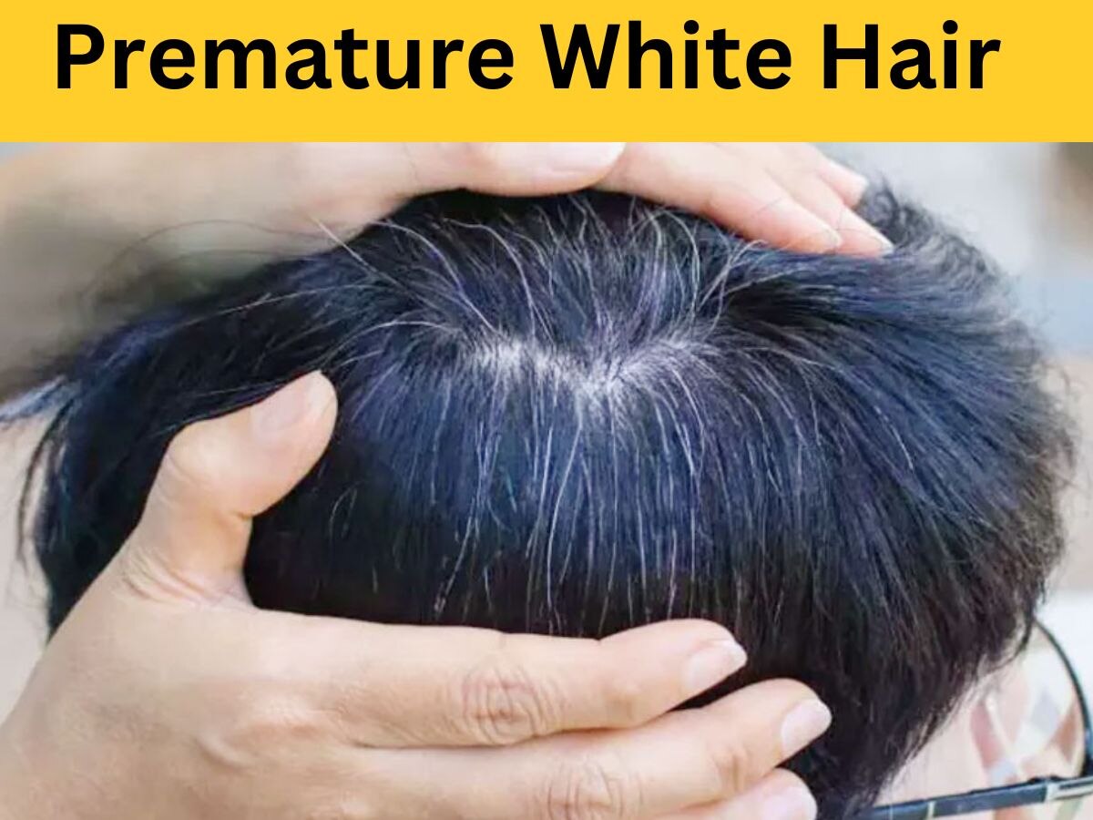 White Hair: इस विटामिन की कमी से सिर पर आते हैं सफेद बाल, कम उम्र में होता है बुढ़ापे का अहसास