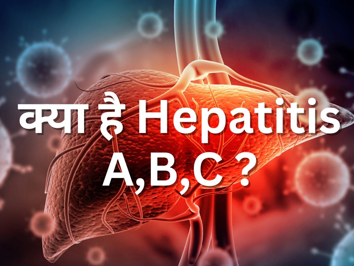 Liver Health: क्या है हैपेटाइटिस A,B,C ? कैसे होता है इसका उपचार 