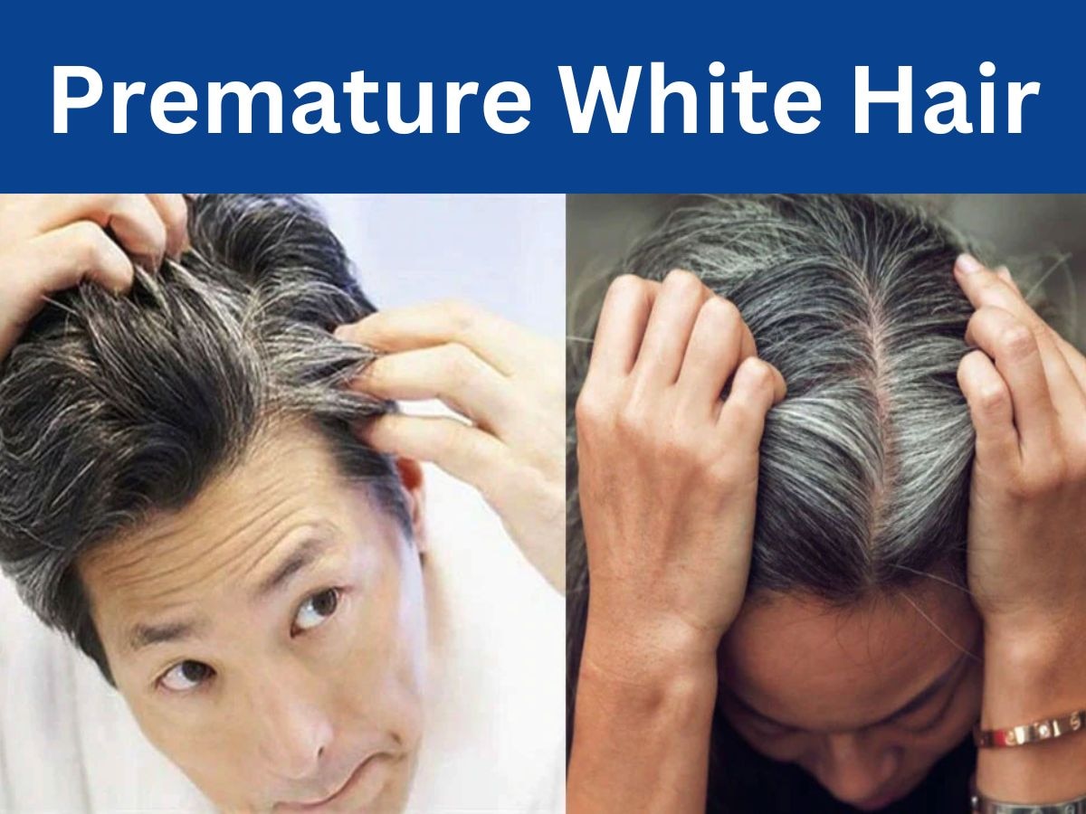 Premature White Hair: इन हरकतों की वजह से 25 साल में ही सिर पर आते हैं सफेद बाल, तुरंत करें तौबा