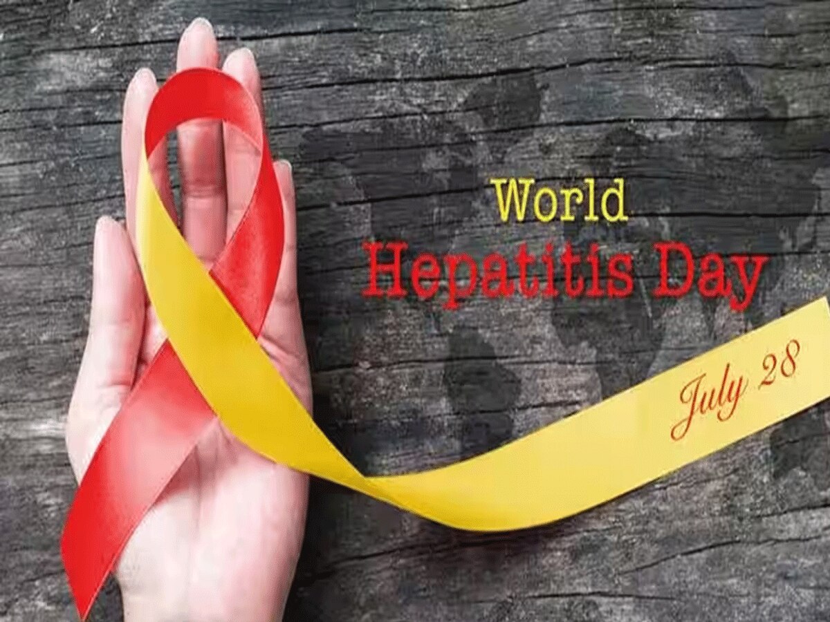World Hepatitis Day 2023: नशे, मोटापे और खून के संक्रमण से फैलता है हेपेटाइटिस, समय रहते कराएं इलाज