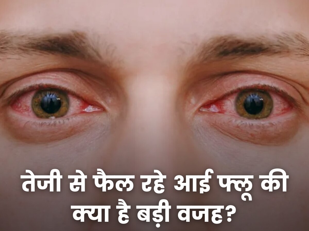 Eye Flu: तेजी से फैल रहे आई फ्लू की बड़ी वजह बन रहा ये वायरस, इन बातों का रखें ख्याल