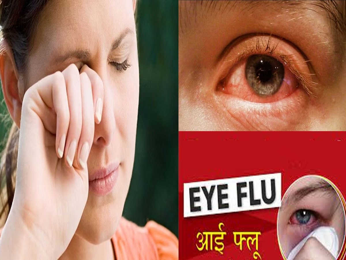 Eye Flu: देशभर में फैला Eye Flu का प्रकोप, आंख लाल हो या गुलाबी; फौरन करें ये उपाय