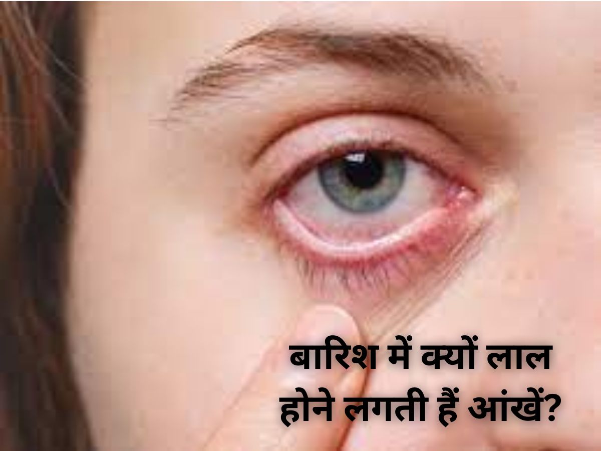 eye infection flu increases during rainy season know precaution tips
