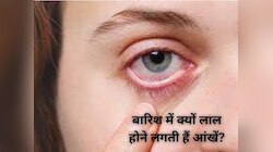 बरसात के मौसम में क्यों फैल रहा है आंखों में इंफेक्शन? जानिए इससे बचने के तरीके