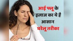 Eye Flu से बचाव के लिए अपनाएं ये घरेलू उपाय, जलन , इचिंग और रेडनेस मिलेगी राहत 