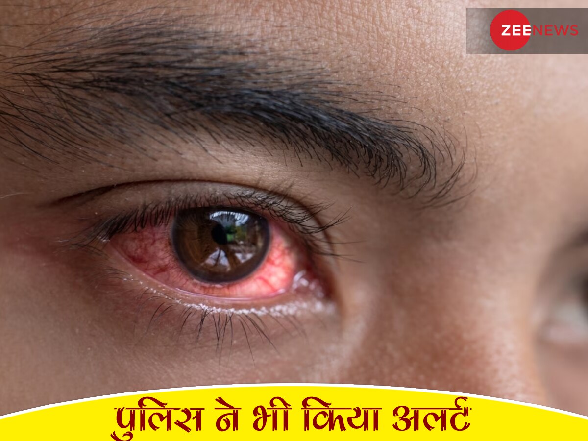 Eye Flu से सावधान! पुलिस ने भी लोगों को कुछ ऐसे किया अलर्ट, लाल-गुलाबी आंख हो तो...