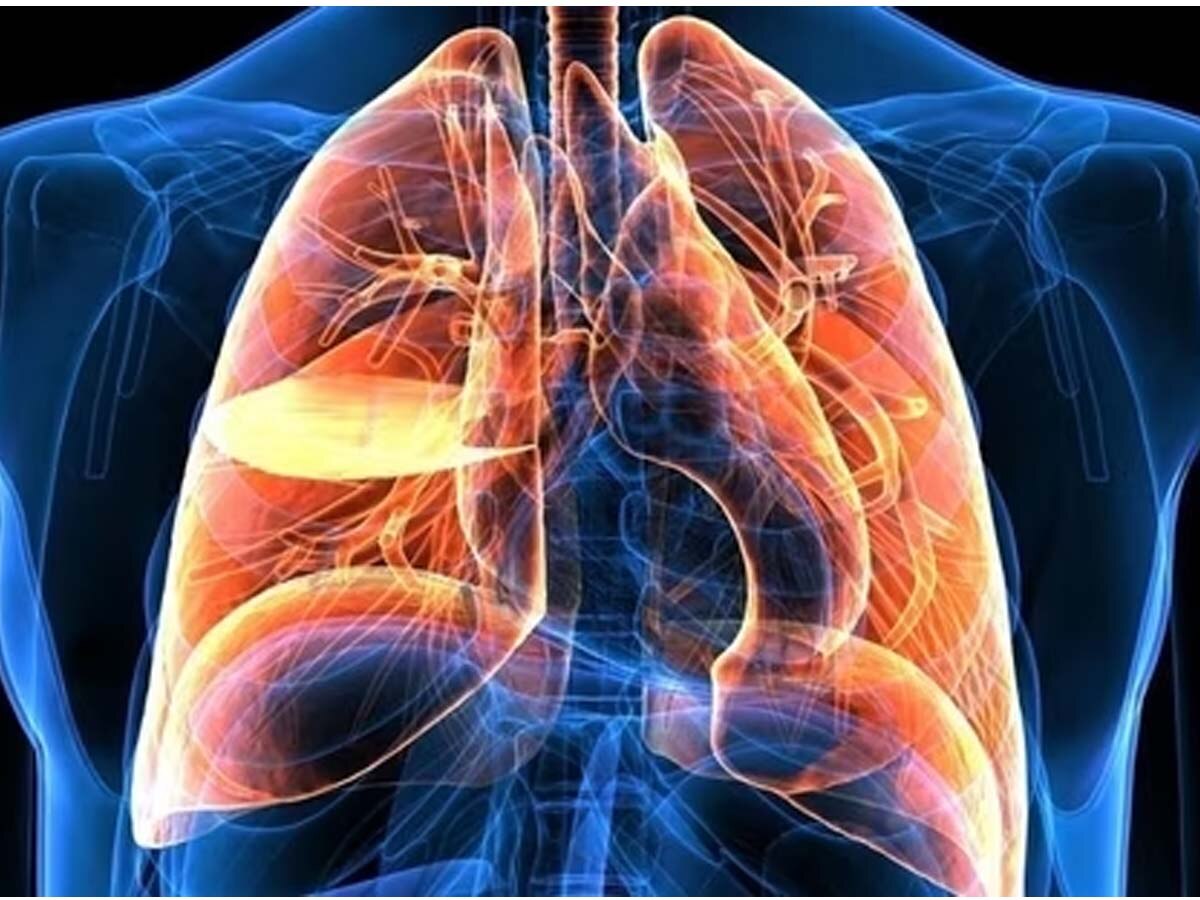 World Lung cancer Day 2023: क्यों होता है लंग्स कैसर; जानें इसके लक्षण और बचने के उपाय