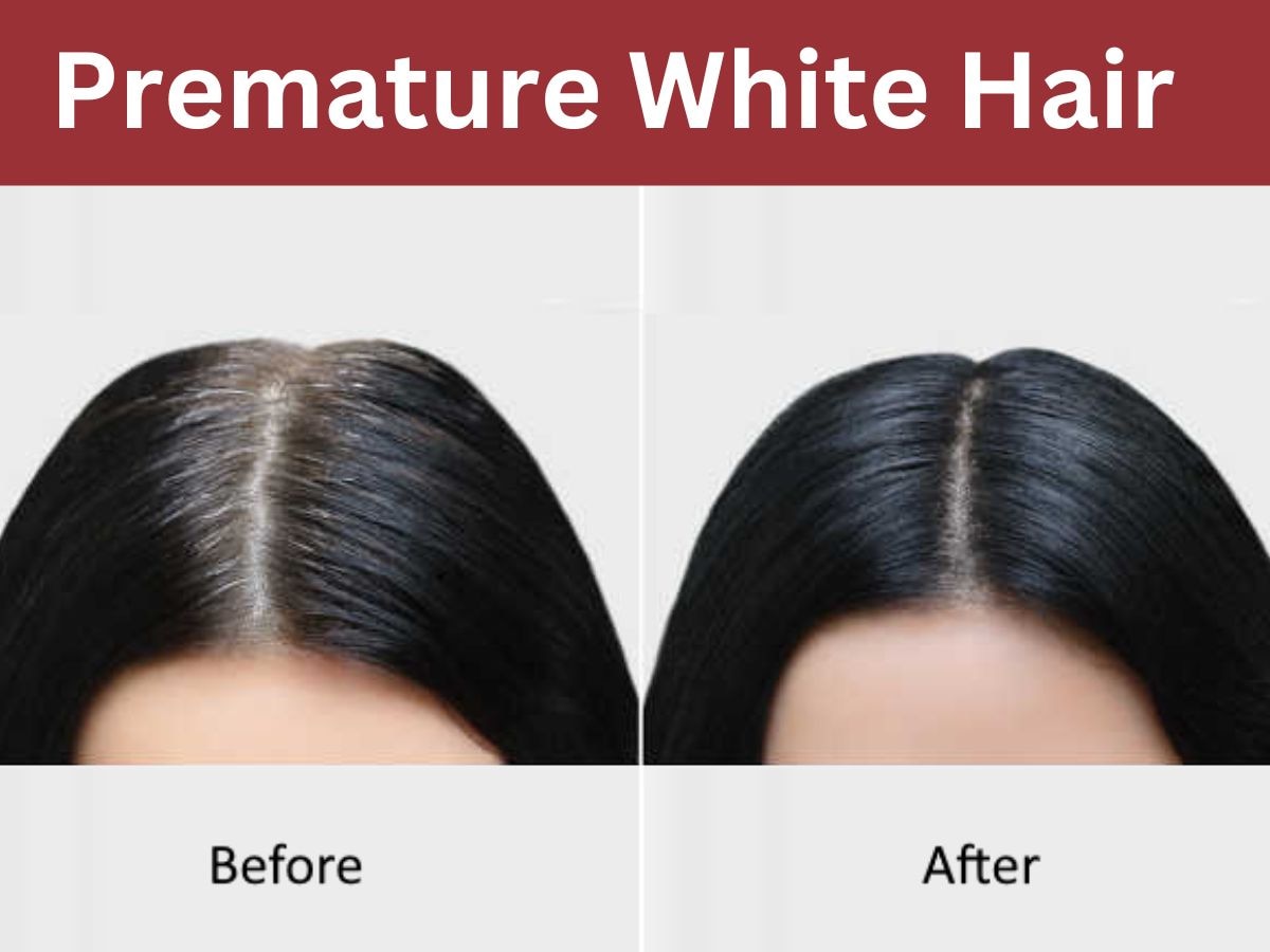 White Hair: कम उम्र में बाल पक जाएं तो होती है टेंशन, इन 3 उपायों के जरिए सफेद बालों से मिलेगी आजादी