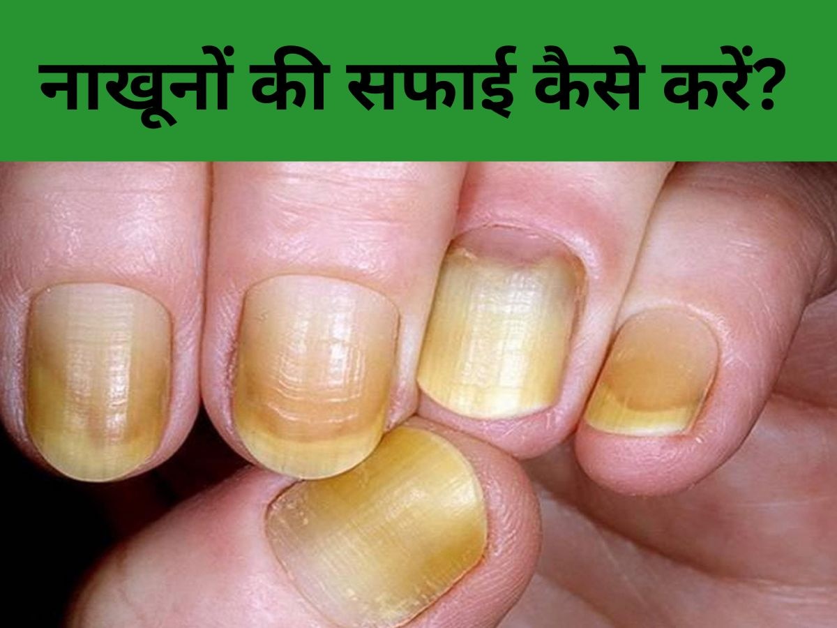 Nails Cleaning: गंदे नाखून भी साफ होकर बन जाएंगे शाइनी, ऐसे बचाएं पार्लर जाने के पैसे 