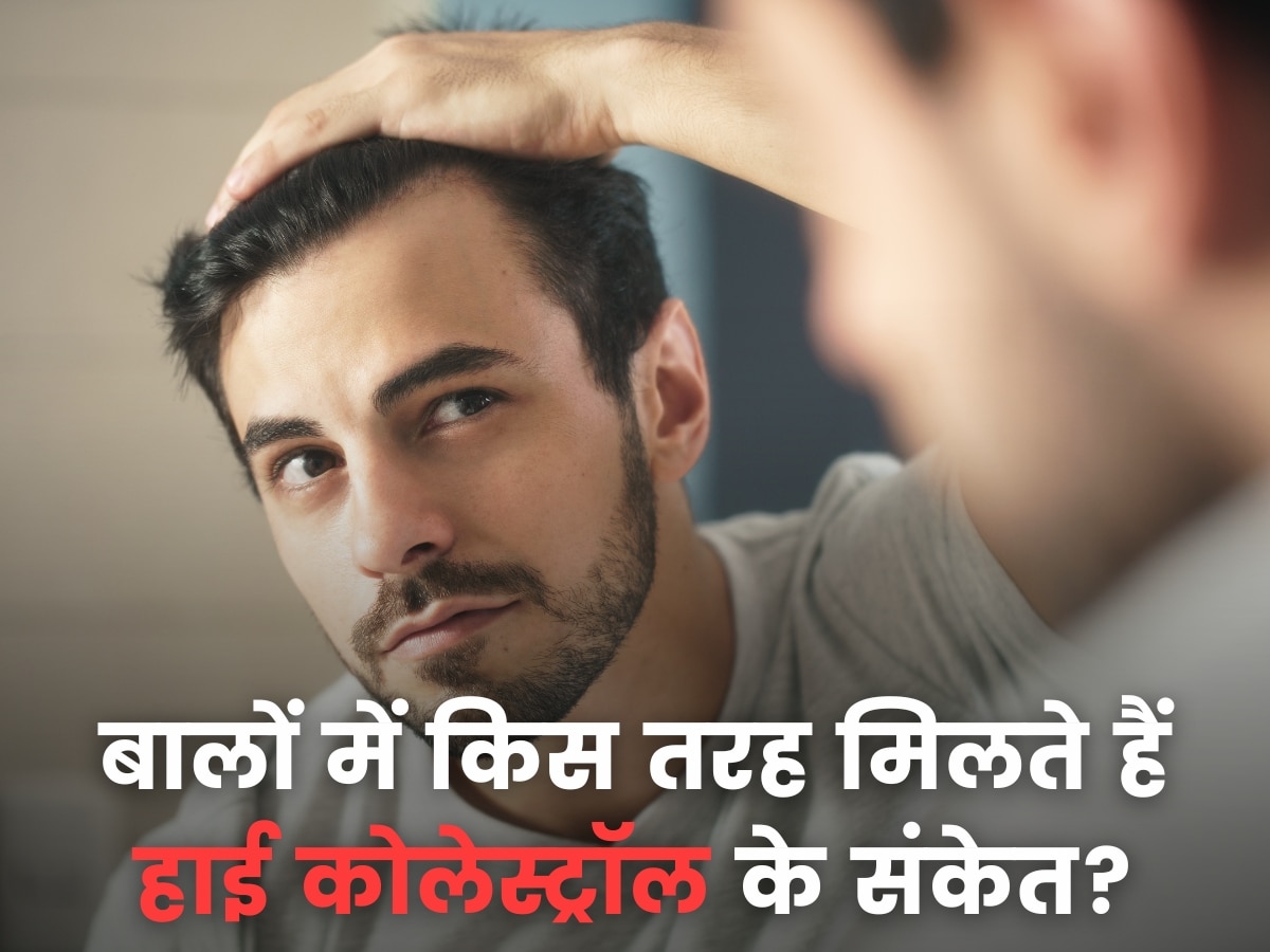 Symptoms of high cholesterol are also visible on hair jane cholesterol