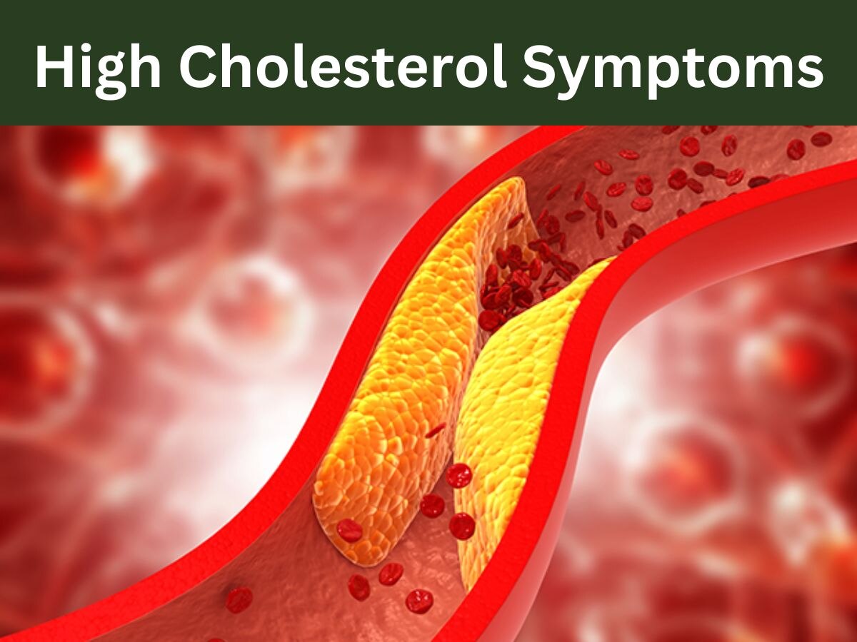 Cholesterol बढ़ने पर शरीर से मिलते हैं खतरे के ऐसे इशारे, नजरअंदाज करना पड़ेगा भारी