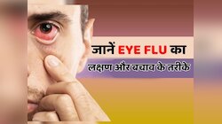 Health tips: Eye Flu के दर्द, जलन और इचिंग से परेशान तो अपनाएं ये आसान घरेलू नुस्खे