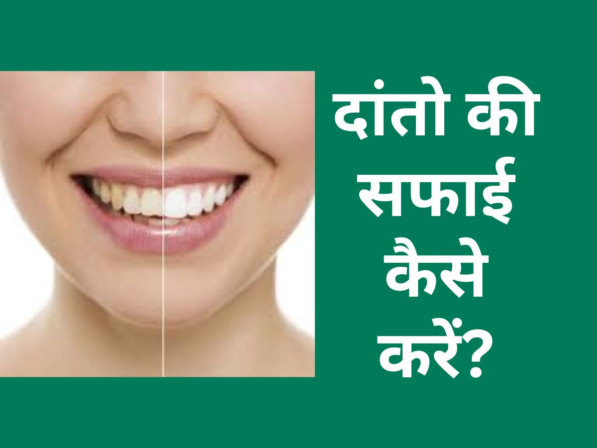 How To Clean Teeth With Easy Steps Cavity Yellowness Whitening Mouth how-to-clean-teeth-with-easy-steps-cavity-yellowness-whitening-mouth