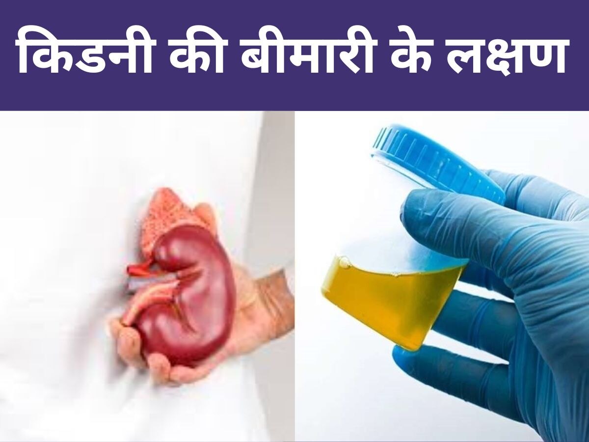 Kidney Problem: यूरिन के रंग से ही नहीं, ऐसे भी चलेगा किडनी डिजीज का पता, जानिए कैसे पहचानें वॉर्निंग साइन 