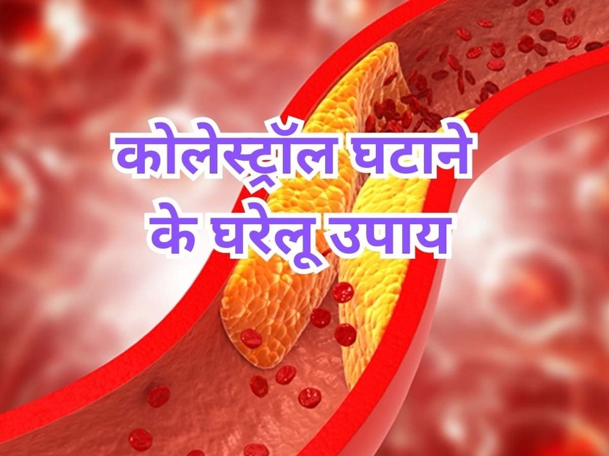 Cholesterol Control Tips: बढ़ा हुआ कोलेस्ट्रॉल कंट्रोल कर देते हैं ये 5 फल, आज से ही शुरू कर दें सेवन; होगा जबरदस्त फायदा