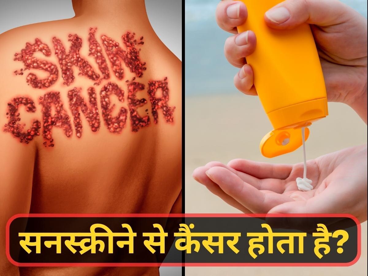 Skin Cancer: क्या सनस्क्रीन लगाने से स्किन कैंसर हो सकता है? जानिए एक्सपर्ट की राय