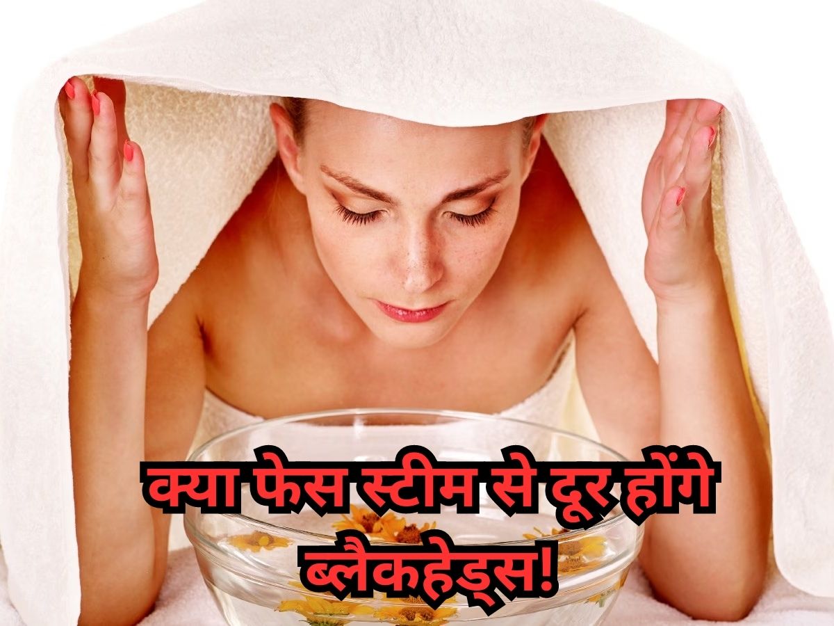 remove blackheads from face take steam once a week try this amazing