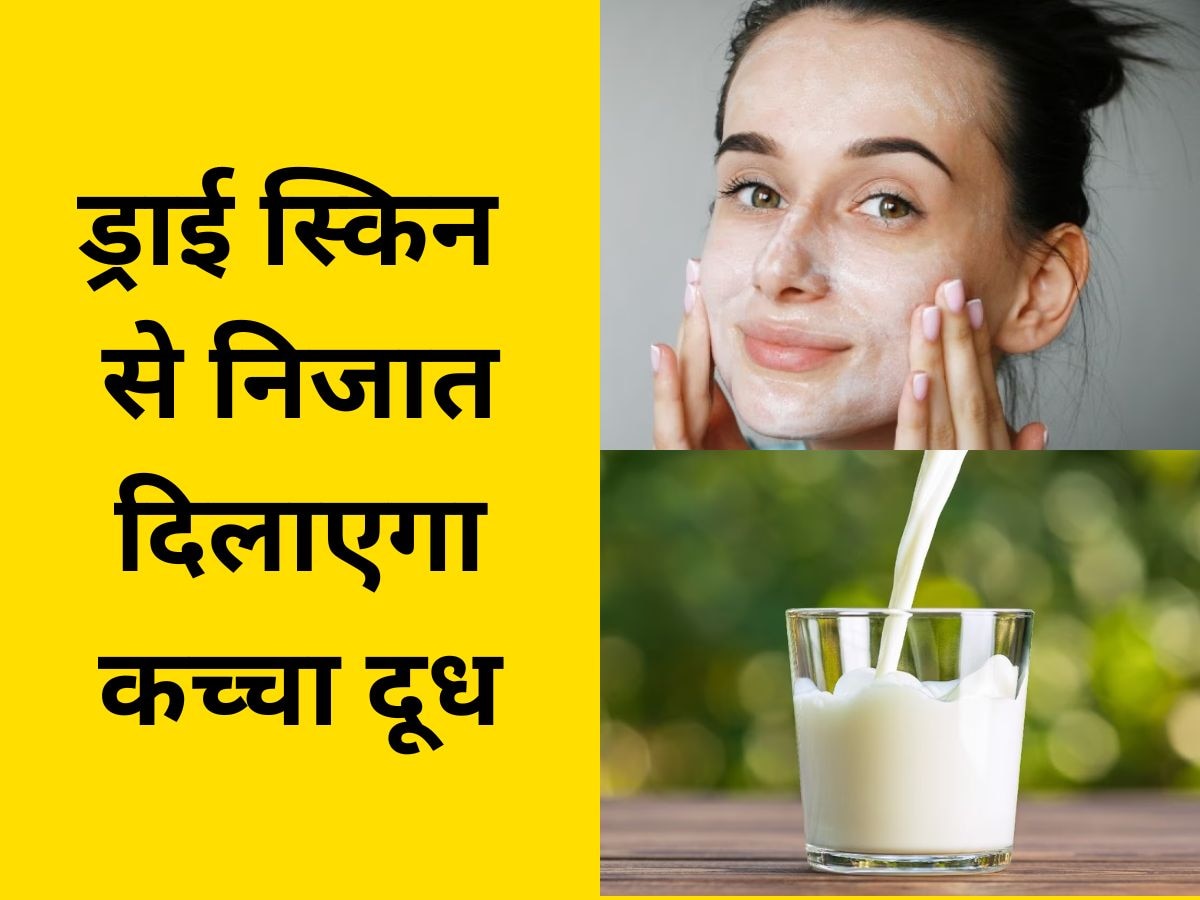 Dry Skin: ड्राई स्किन की वजह से बिगड़ गया चेहरे का लुक? इस तरह करें कच्चे दूध का इस्तेमाल