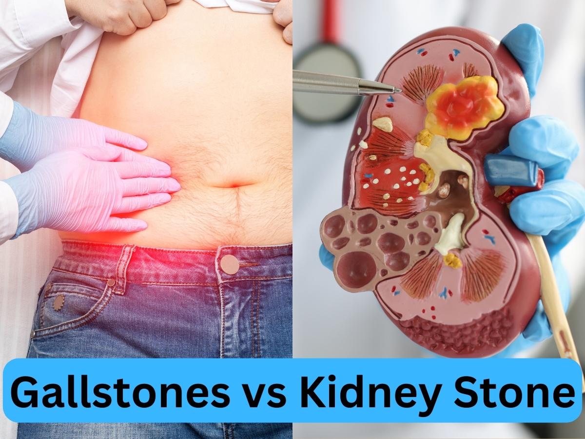 Know the difference between gallstones and kidney stones understand the