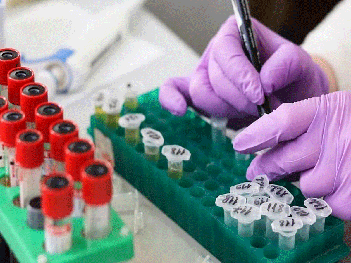 US Hereditary Testing Case: हेल्थ सेक्टर में अरबों रुपये का घोटाला, बुरे फंसे लाखों लोग; भारत से है कनेक्शन US Hereditary Testing Case: हेल्थ सेक्टर में अरबों रुपये का घोटाला, बुरे फंसे लाखों लोग; भारत से है कनेक्शन