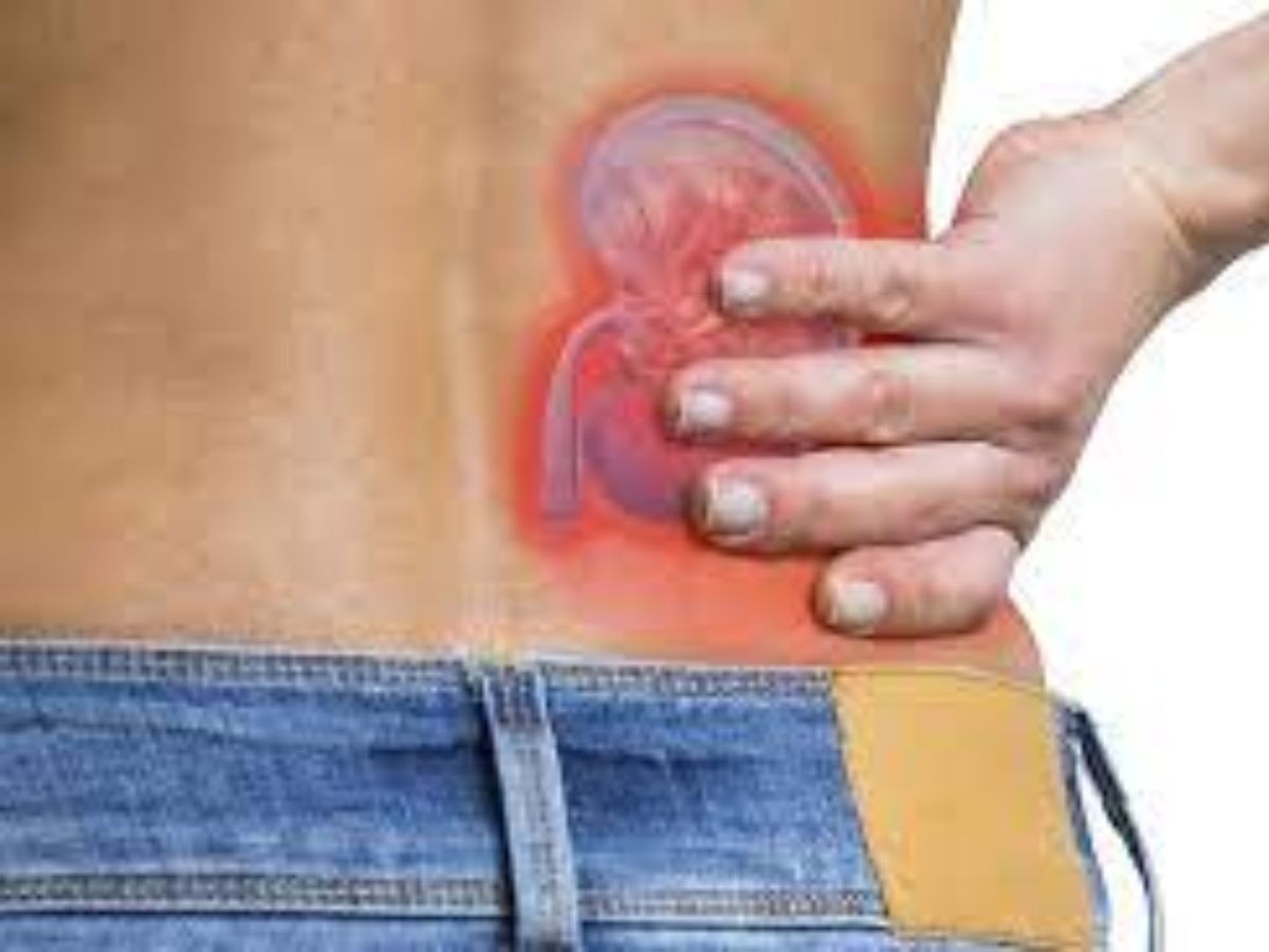 kidney Stone Early Symptoms