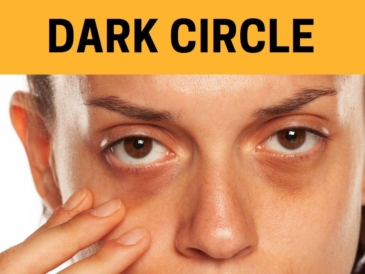 How To Get Rid Of Dark Circle Under Eyes Using Milk Home Remedies
