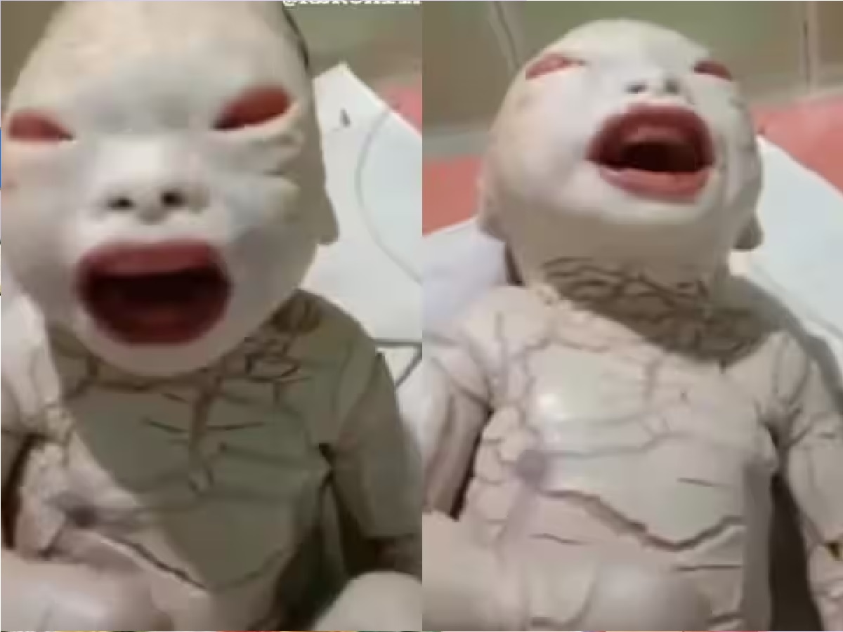 Alien News harlequin ichthyosis