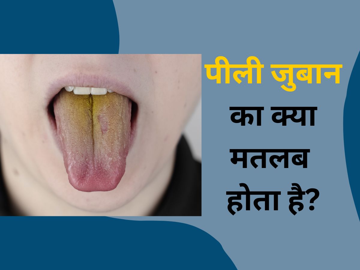 What is the Meaning Of Pale Yellow Tongue Peeli Zuban Ka Kya Matlab