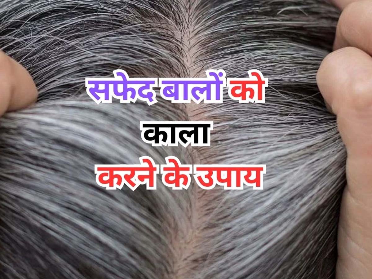 White Hair Remedies Potato Peels Benefits for grey hair White Hair Remedies तेजी से सफेद होते