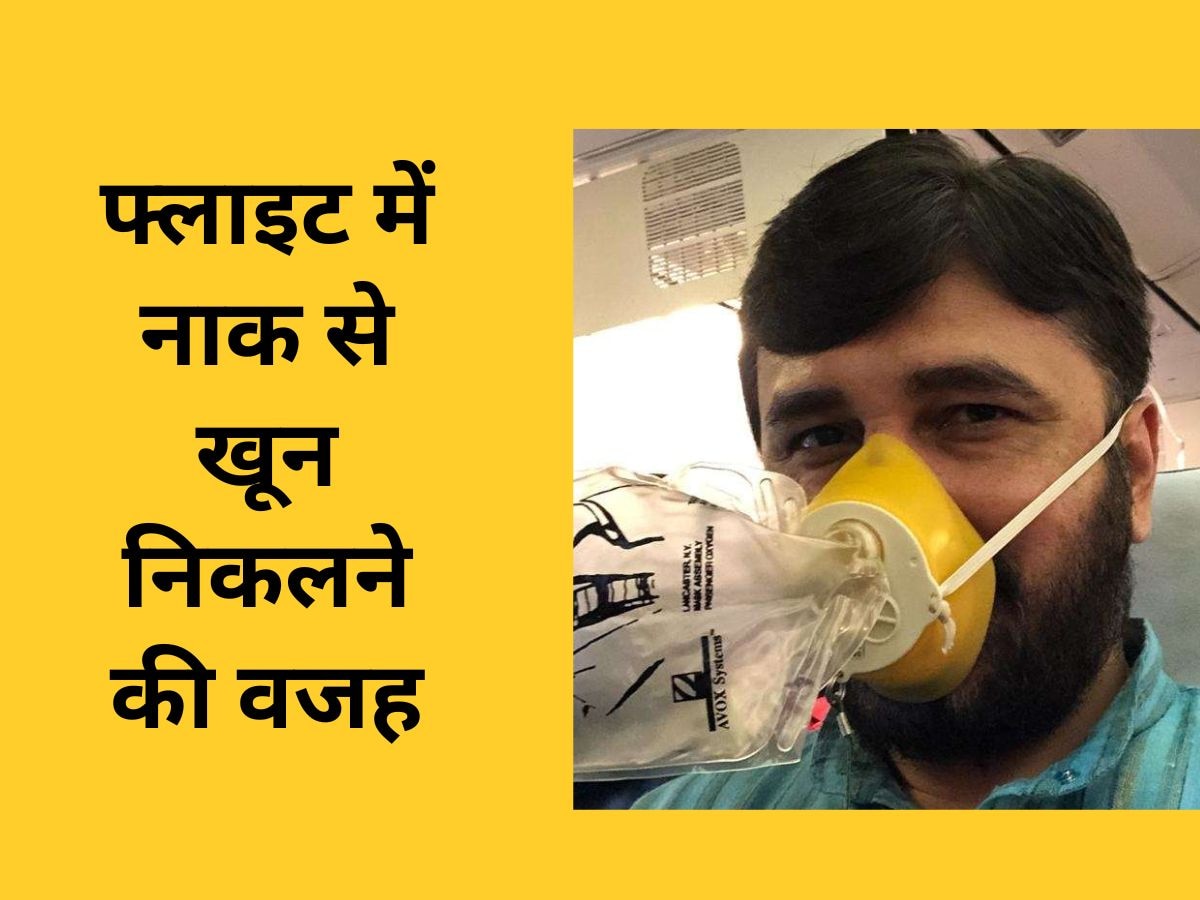 Nose Bleeding: कुछ लोगों को हवाई जहाज में नाक से क्यों निकलता है खून? फ्लाइट में सफर करते हैं तो जान लें ये सच