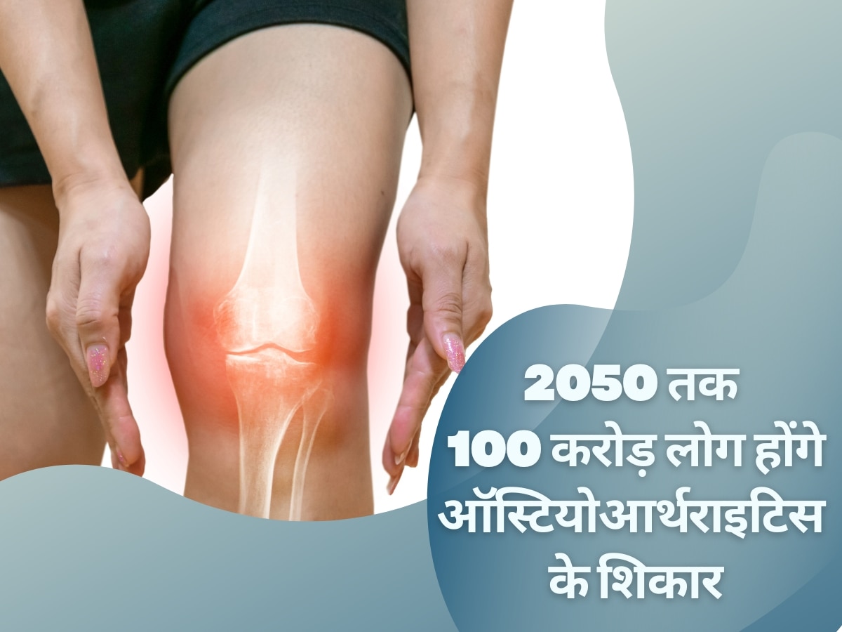 Osteoarthritis: 2050 तक 100 करोड़ लोग होंगे ऑस्टियोआर्थराइटिस के शिकार! जानिए किस तरह मिलते हैं लक्षण