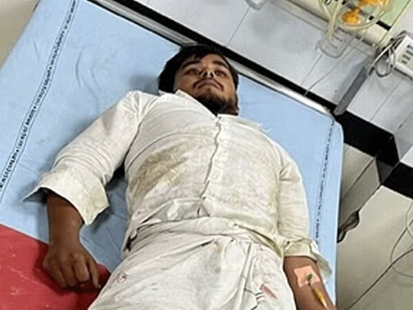  Nuh Encounter News: नूंह हिंसा के आरोपी ओसामा के पैर में पुलिस ने मारी गोली; जानें पूरा मामला