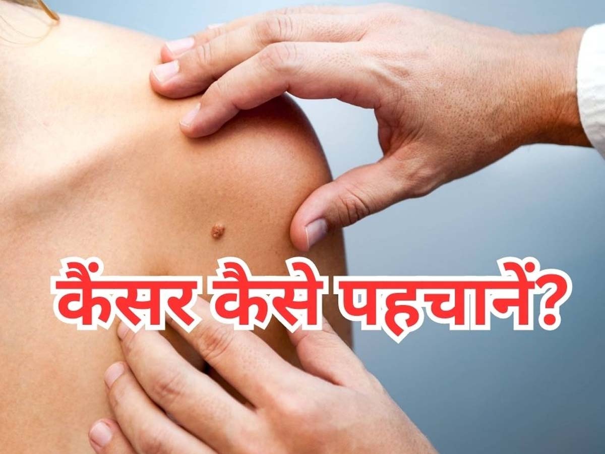 Cancer Symptoms: बार- बार आने लगे डकार तो भूलकर भी न करें इग्नोर, कैंसर का हो सकता है लक्षण; तुरंत कर लें ये काम