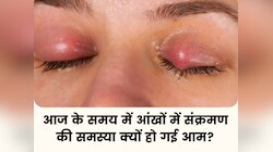 Eye Infection: आंखों में बढ़ते संक्रमण के पीछे क्या है कारण? भारत में स्थिति गंभीर!