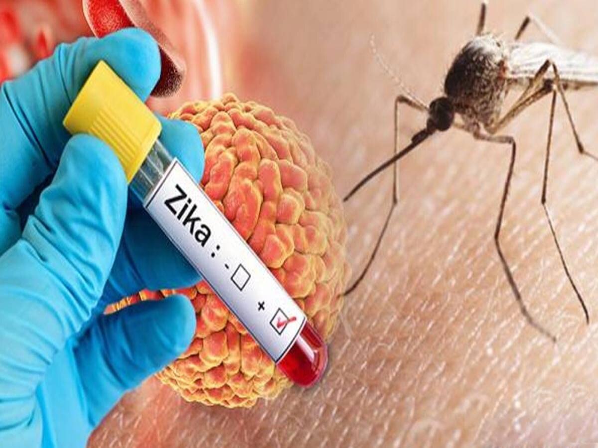 मुंबई में मिला Zika Virus का पहला केस; BMC ने कहा-'स्वयं ठीक होने वाली बीमारी'