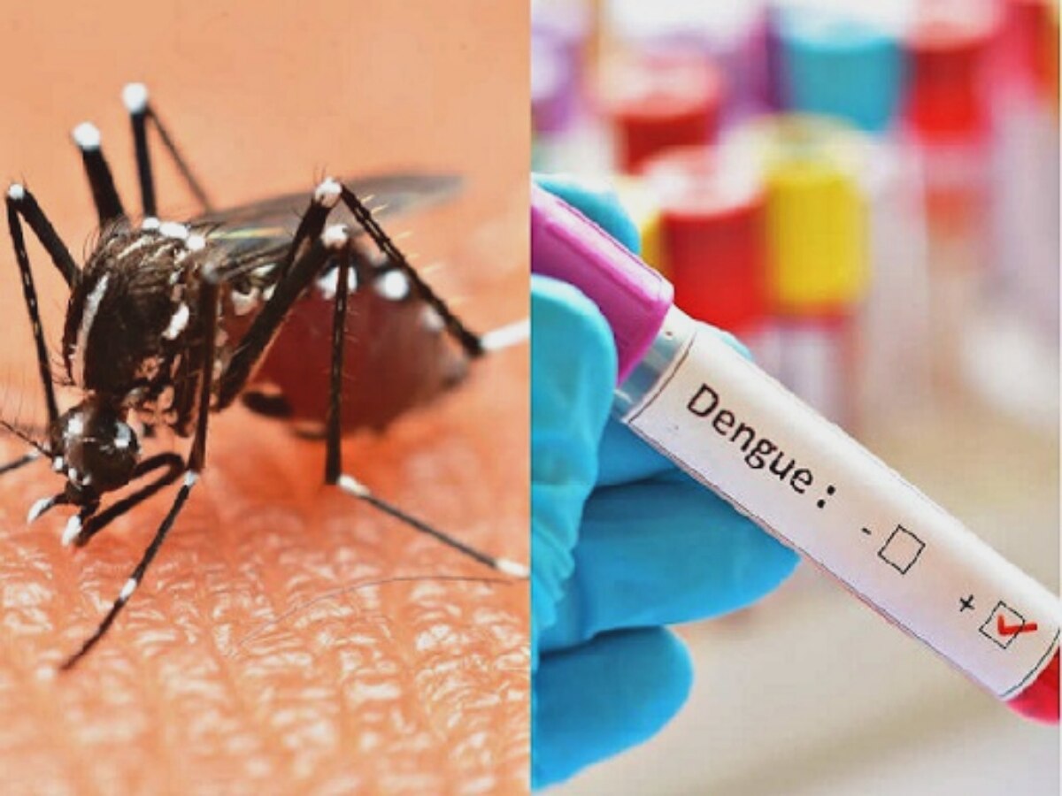Dengue In MP: बारिश थमते ही बढ़ा डेंगू! मध्य प्रदेश से सामने आए डरावने आंकड़े; जानें उपाय