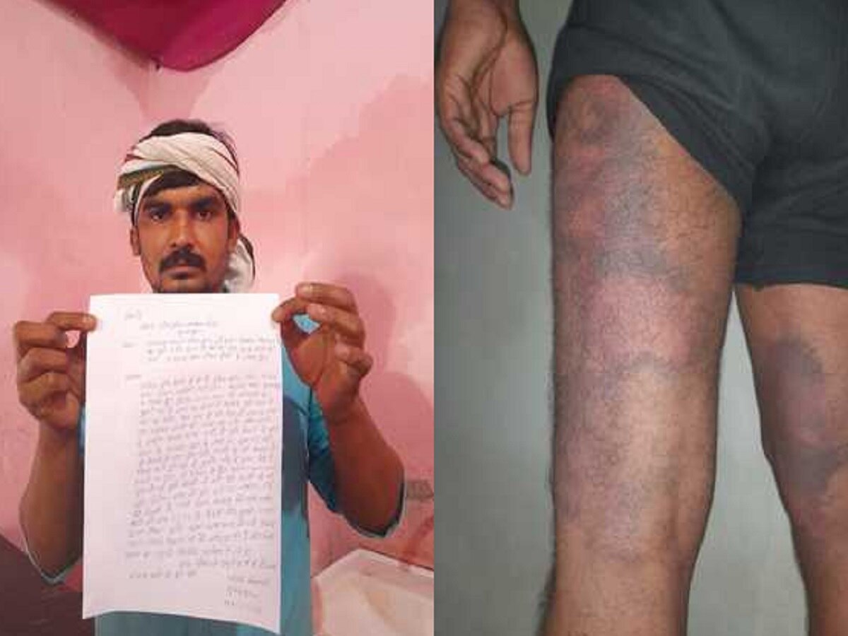 Bihar News: मुजफ्फरपुर में थानेदार पर लगा पिटाई का गंभीर आरोप, डीएसपी ने कहा मामले की होगी जांच