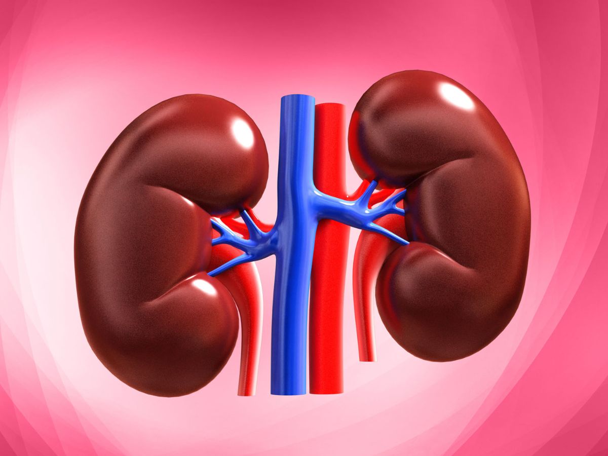 किडनी स्टोन