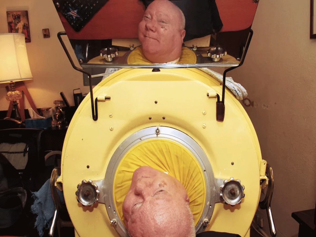 Miracle Man With Iron Lung Paul Alexander Inspirational Story Man Who Lying Down In Machin From 