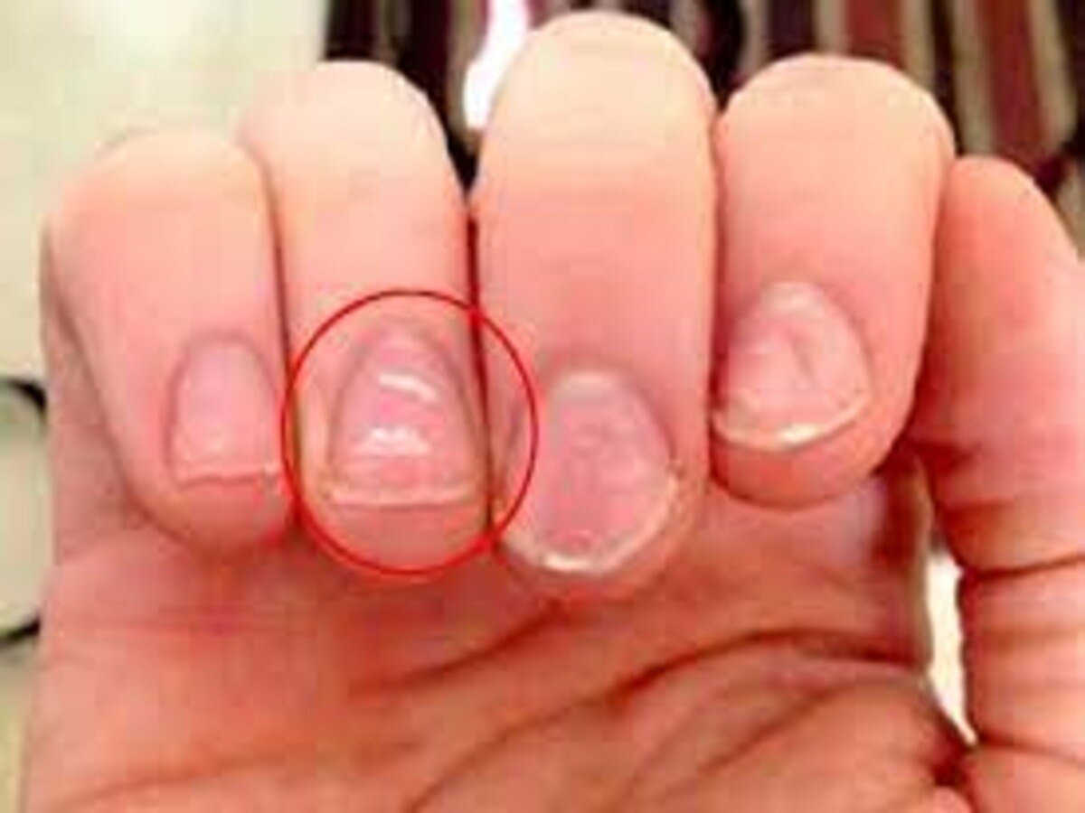 Samudrik Shashtra नाखून के सफेद निशान भी बयां करते हैं बहुत सी बातें