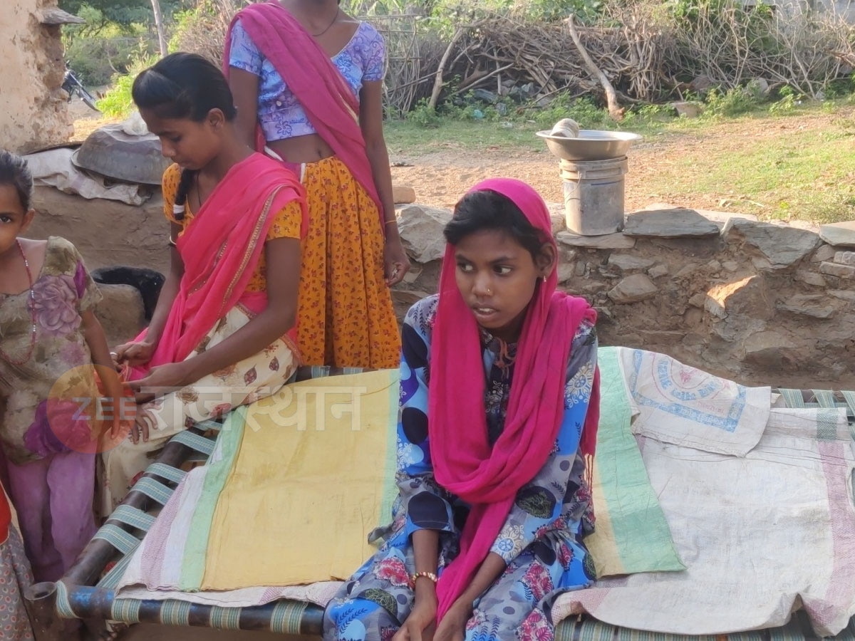 राजसमंद: 13 साल की बालिका मीना को मिला नया जीवन, बालिका के फेफड़ों में पानी भरने का था मामला