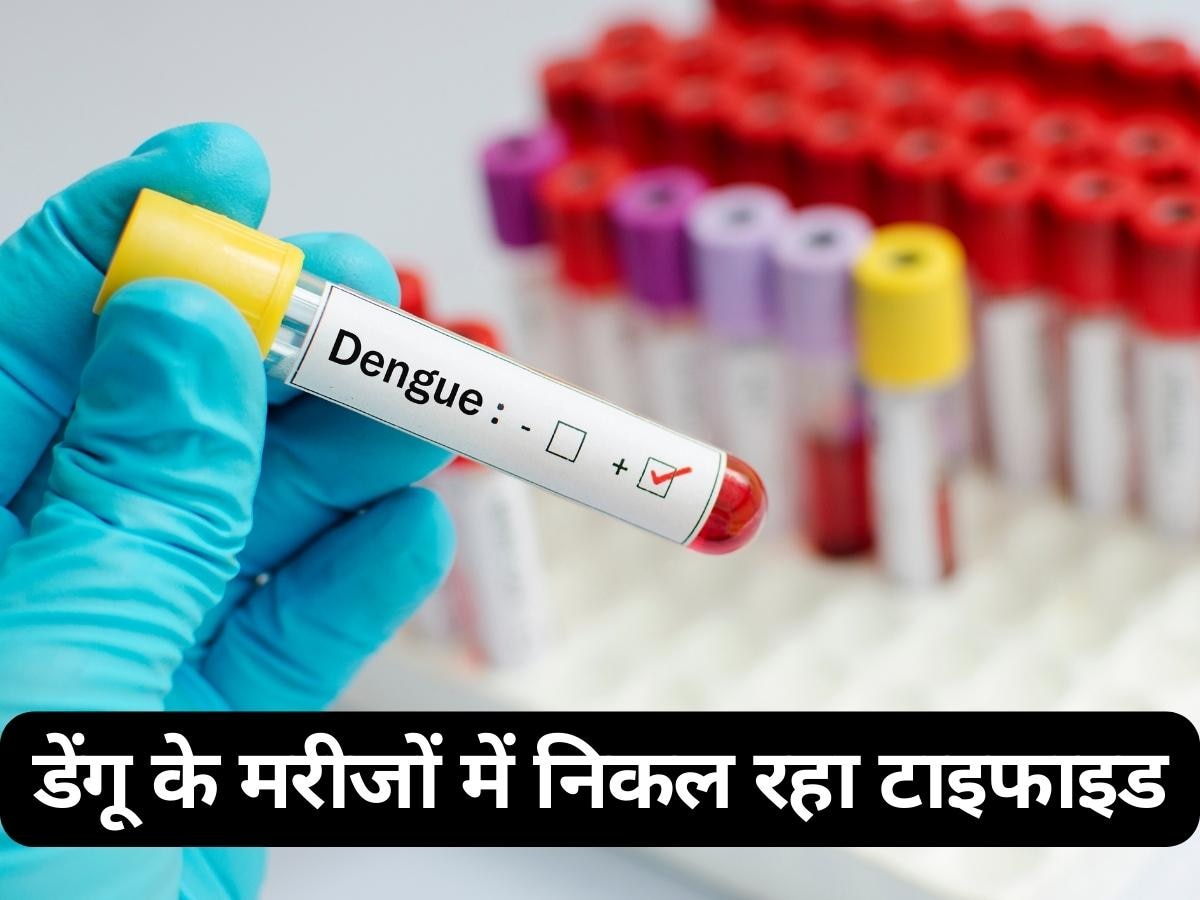 Dengue: डेंगू के मरीजों में निकल रहा टाइफाइड, जल्दी ठीक होने के लिए क्या घरेलू उपाय अपनाएं?