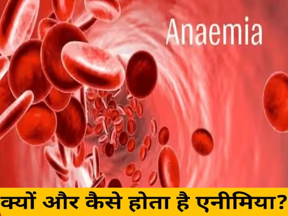 Anemia: दुनिया का हर चौथा शख्स इस बीमारी से प्रभावित, आज ही जानें लक्षण और बचाव का तरीका