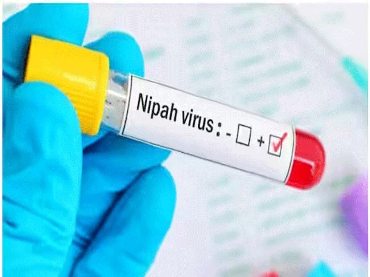 Nipah Virus: इस पेड़ से फैला कोरोना से ज्यादा जानलेवा निपाह वायरस? केरल में मचा हड़कंप