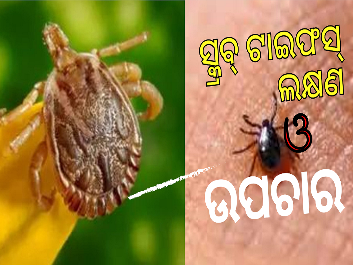 Scrub Typhus: ସ୍କ୍ରବ୍ ଟାଇଫସ୍ କ’ଣ ଯାହା ଲୋକଙ୍କୁ ଅସୁସ୍ଥ କରାଉଛି? ଜାଣନ୍ତୁ ଏହାର ଲକ୍ଷଣ ଓ ଉପଚାର Scrub Typhus: ସ୍କ୍ରବ୍ ଟାଇଫସ୍ କ’ଣ ଯାହା ଲୋକଙ୍କୁ ଅସୁସ୍ଥ କରାଉଛି? ଜାଣନ୍ତୁ ଏହାର ଲକ୍ଷଣ ଓ ଉପଚାର