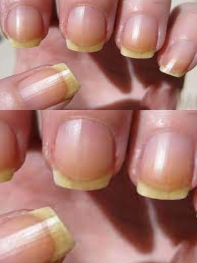 Darling - Don't wear nail polish all the time. Wearing nail polish every  day actually causes your nails to turn yellow! | Facebook