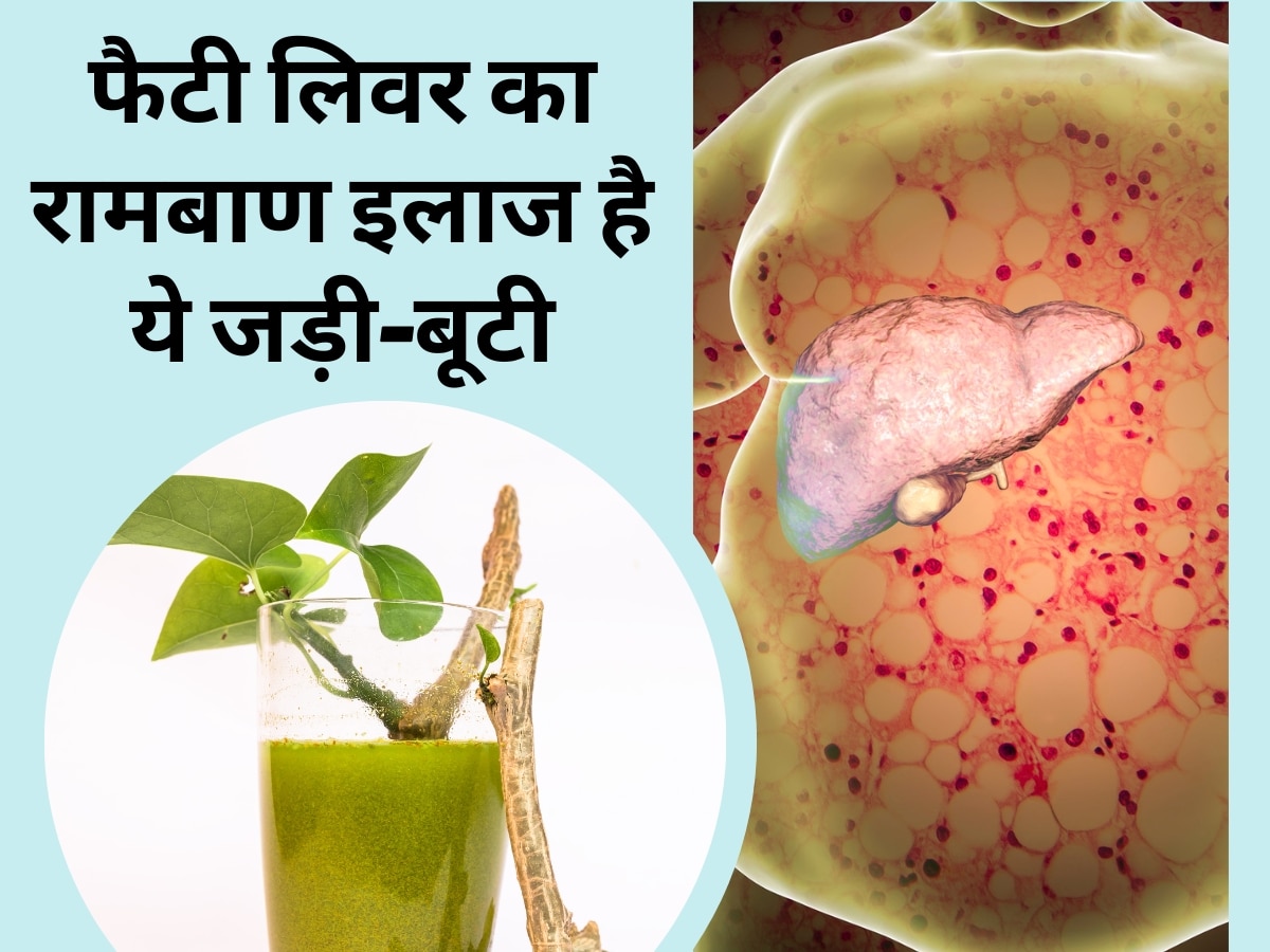 Fatty Liver Disease: फैटी लिवर का रामबाण इलाज है ये जड़ी-बूटी, डायबिटीज का खतरा भी होगा कम