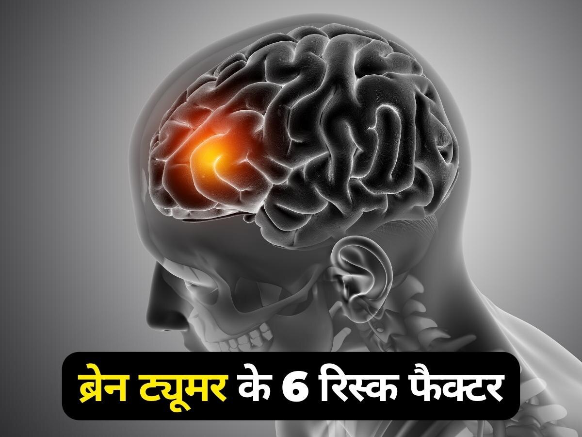 Brain Tumor: ब्रेन ट्यूमर के इन 6 रिस्क फैक्टर को जान लें आप, अधिकतर लोग कर देते हैं नजरअंदाज