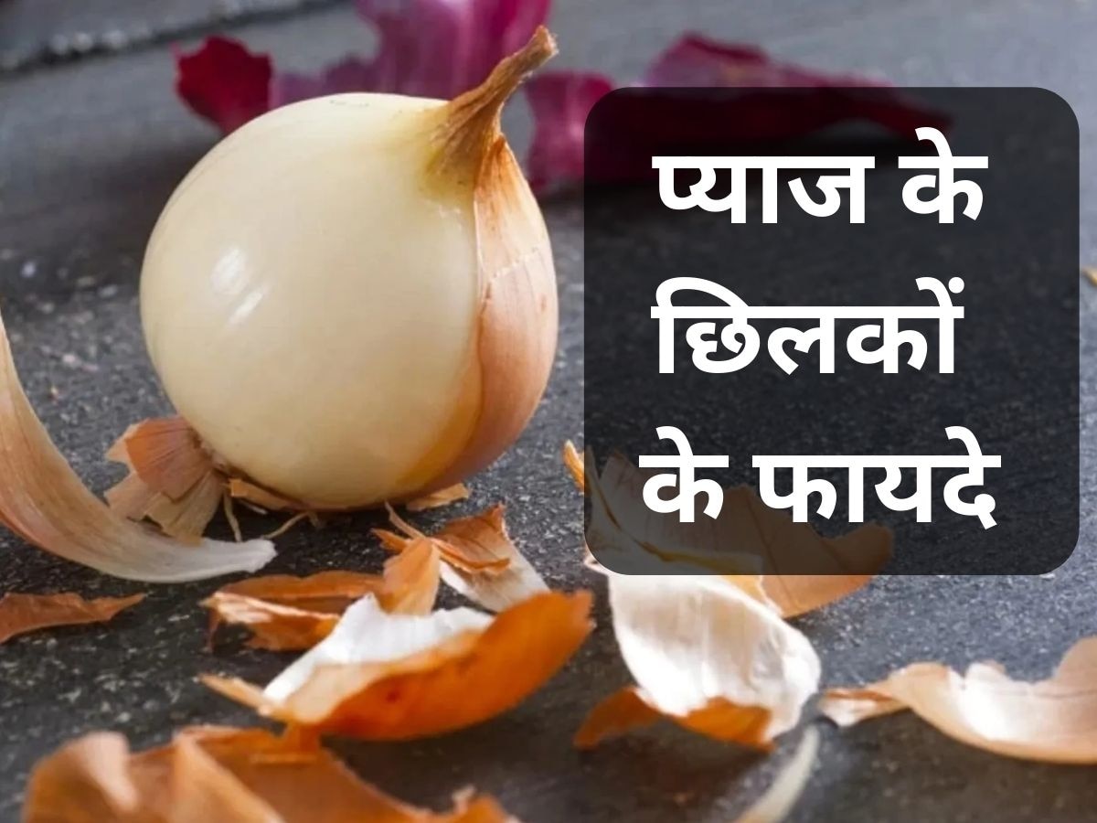 Onion Peels: बेकार समझकर कचरे में न फेंकें प्याज के छिलके, इस तरह यूज करेंगे तो होंगे फायदे